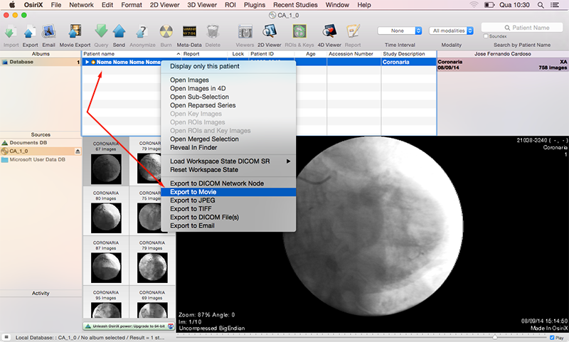 Osirix